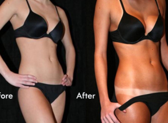 Mobile Spray Tanning Rose to the Occasion - Norwalk, CT