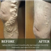 Center For Advanced Vein Care gallery