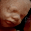 Over The Womb 4d Ultrasound & Photography gallery