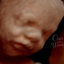 Over The Womb 4d Ultrasound & Photography - Ultrasonic Equipment & Supplies