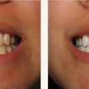 Martin Jeff DDS - Teeth Whitening Products & Services