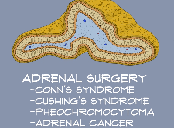 Steven E. Rodgers, MD, PhD - Miami, FL. Adrenal Surgery