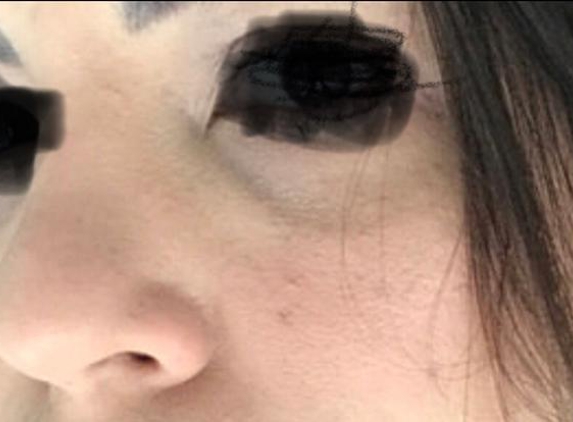 Secrets Of Beauty Cosmetic Medicine - Huntingdale, VIC. Awful filler