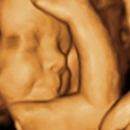 Sweet Pea in 3D - Medical Imaging Services