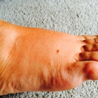 Sprain Brook Podiatry