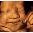 4D Moments Ultrasound LLC