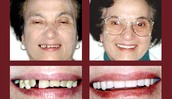 Advanced Dentistry - Ralph S. Reilly, DMD - Middlesex, NJ