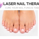 Laser Nail Therapy- Largest Toenail Fungus Treatment Center - Clinics