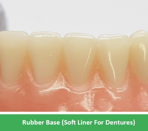 Complete Denture Care - Wantirna, VIC. Rubber Base (Soft Liner For Dentures)