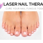 Laser Nail Therapy Clinic--Toenail Fungus Treatment Glendale