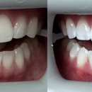 Martinson Family and Cosmetic Dentistry - Implant Dentistry