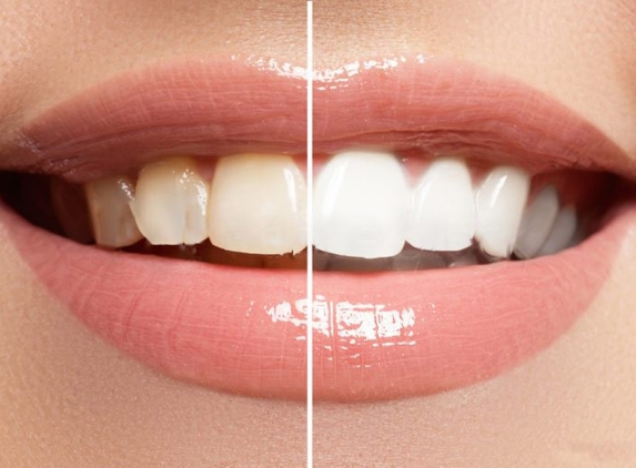 Heatherton Dental - Dandenong North, VIC