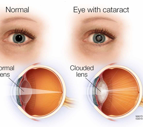 Eye Surgicentre The - Erina, NSW