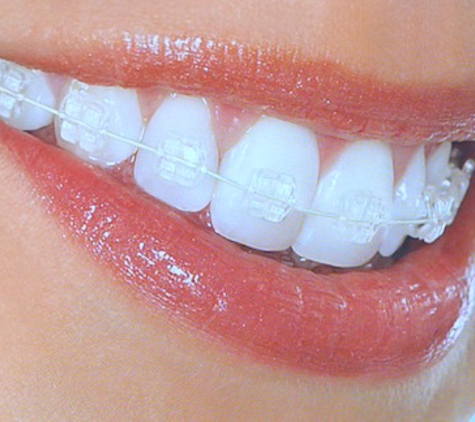 True Orthodontics, PC. John J. Lupini DDS, MS - Trenton, MI