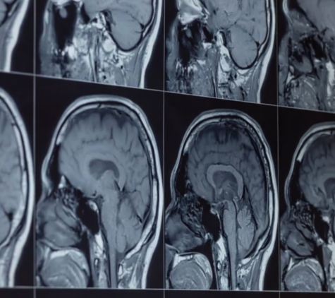 Queensland Neurosurgery & Spine Surgery - Greenslopes, QLD
