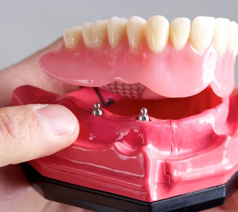 Geelong Denture Care Centre - Geelong, VIC