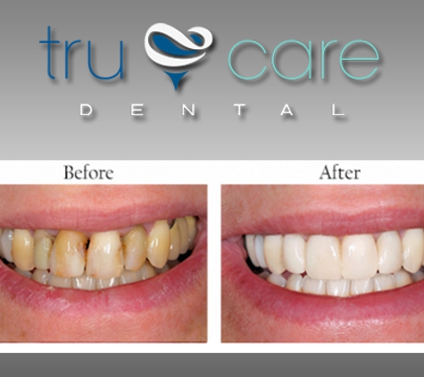 Tru Care Dental - Albuquerque, NM