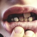 Zooka Super Toothcare For Kids - Dentists