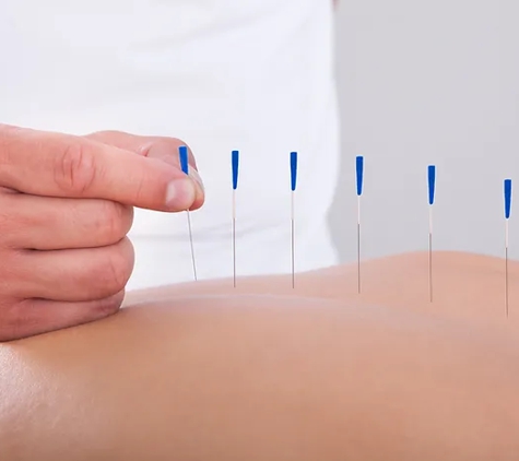 Effective Physiotherapy & Sports Injuries Clinic - Cromer, NSW