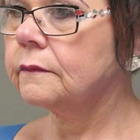Dakota Plastic Surgery