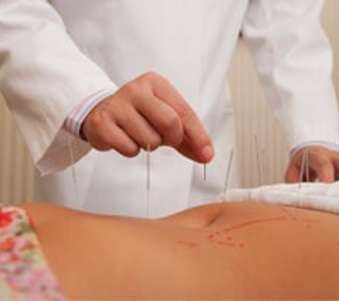 Acupuncture & Traditional - Littleton, CO