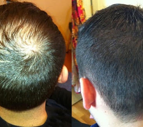 Suisse Natural Hair Salon - Newton, MA. hair replacement for men