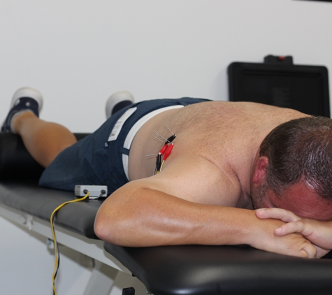 V6 Physical Therapy & Performance - Kansas City, MO. Dry needling for shoulder pain