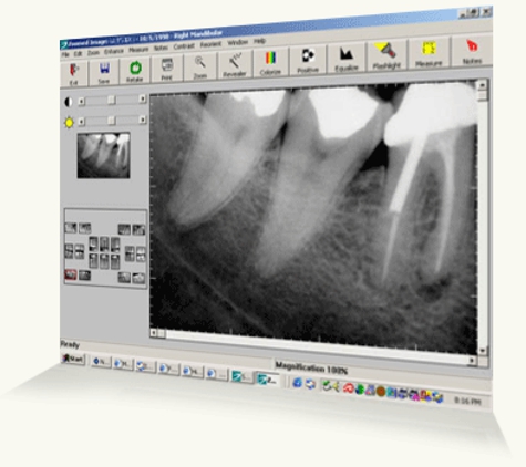 Middlebury Dentist - Middlebury, CT. High-tech digital x-rays allows us the best clarity and quality.