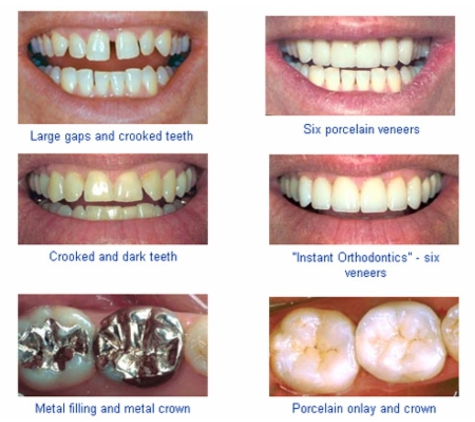 Dentist For Chickens - Swansea Dental Care - Blacksmiths, NSW