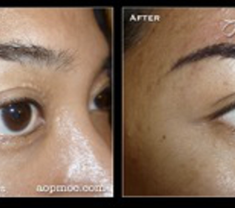 Artistry of Permanent Makeup - Mission Viejo, CA