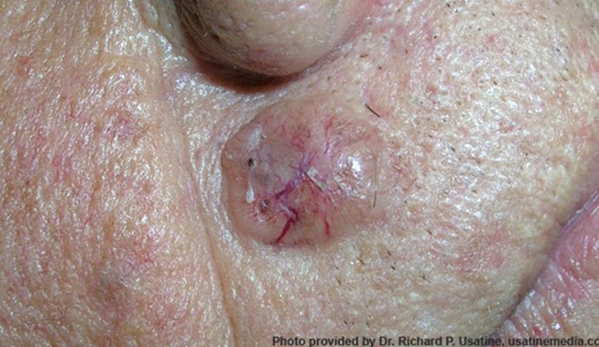 Port Macquarie Skin Cancer Clinic - Port Macquarie, NSW