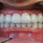 A-Implant Dental Lab Inc