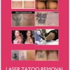 AAA Jewelry,ear piercing,laser tattoo removal... gallery