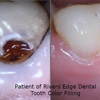 Rivers Edge Dental gallery