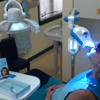 Smile Labs Teeth Whitening gallery