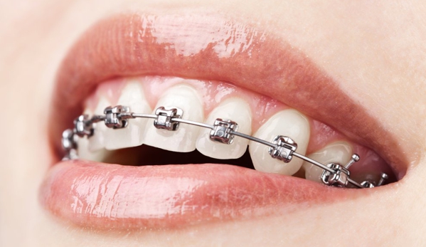 SINAI DENTAL - Van Nuys, CA. Orthodontics