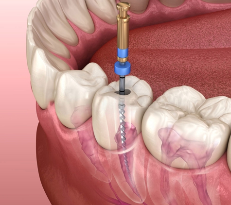 Heatherton Dental - Dandenong North, VIC