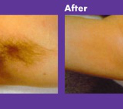 las vegas laser skin care - Las Vegas, NV