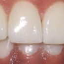 StarWhite Dental - Implant Dentistry