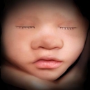 8K Enhanced Ultrasound Images - Pregnancy Information & Services