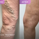 Vein Treatment Clinic Huntington Beach - Clinics