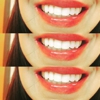 Radiant White Smiles of Austin Cosmetic Teeth Whitening gallery