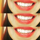 Radiant White Smiles of Austin Cosmetic Teeth Whitening - Teeth Whitening Products & Services