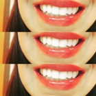 Radiant White Smiles of Austin Cosmetic Teeth Whitening