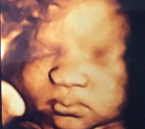 Peek Of Joy 3D Ultrasound & Spa - Williamsburg, VA