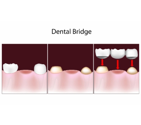 Yamanto Dental Surgery - Yamanto, QLD