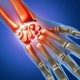 The Hand and Upper Extremity Institute of South Texas