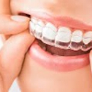 Braces Orthodontics Pediatrics-Bop Braces - Dentists