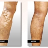 USA Vein Clinics gallery