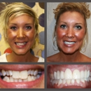 Advanced Dental Concepts - Dr. Danny L. Hayes - Implant Dentistry